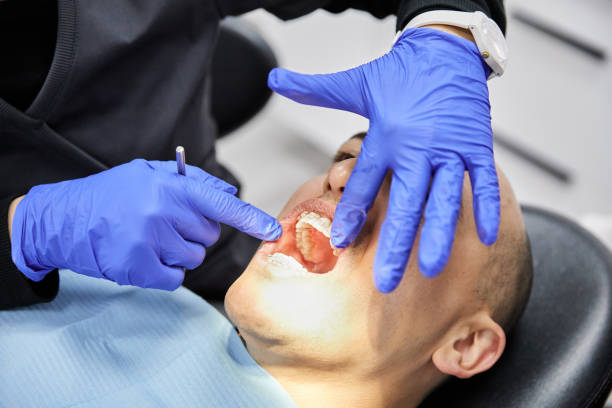 Best Urgent Care for Lost Fillings or Crowns in North Patchogue, NY